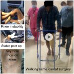 Walking with stand after knee replacement