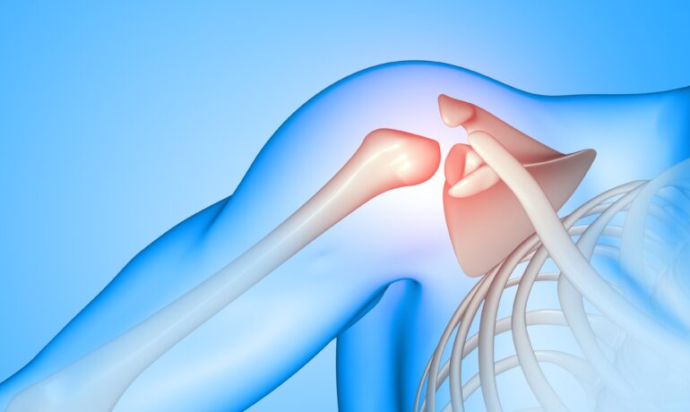 Shoulder Arthroscopy